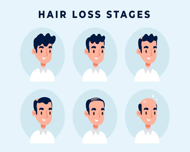 Boost Your Confidence with Personalized Hair Transplant Solutions at ITM Hospital, Gwalior