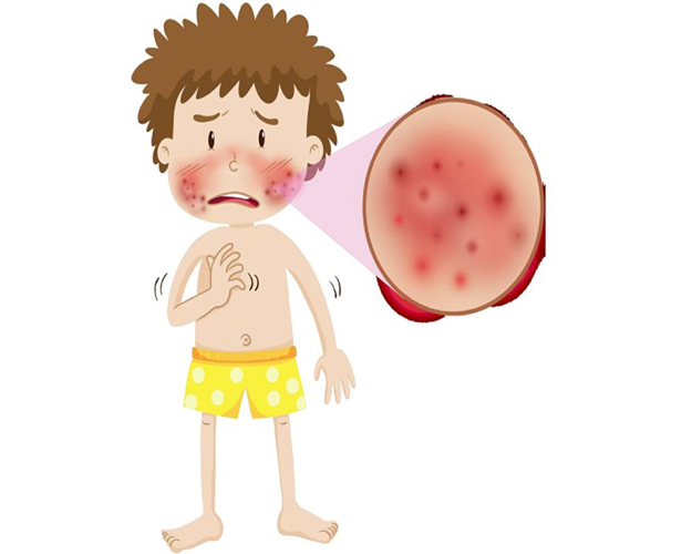 Lupus Treatment at ITM Hospital & Research Centre: Advanced Care for a Complex Disease