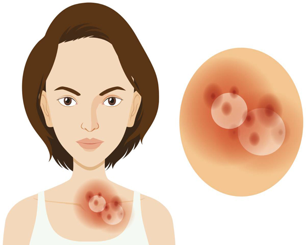 Skin and Venereal Diseases: A Comprehensive Guide to Diagnosis and Care