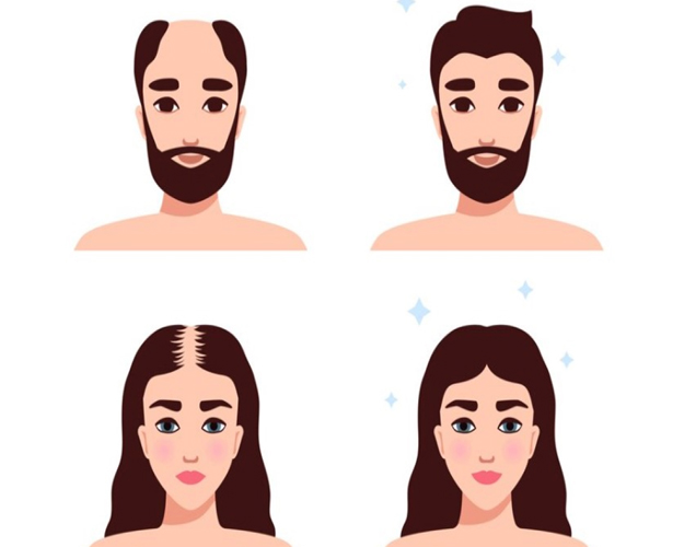 Change Your Look, Change Your Confidence: Know in-depth about the customized hair transplant services available at ITM Hospital, Gwalior