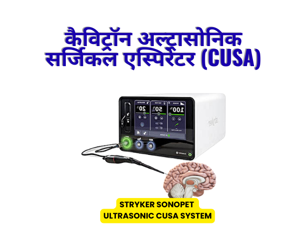 कैविट्रॉन अल्ट्रासोनिक सर्जिकल एस्पिरेटर (CUSA): जटिल सर्जरी में एक आधुनिक तकनीक