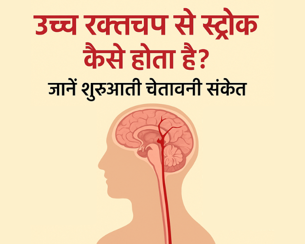 उच्च रक्तचाप से स्ट्रोक कैसे होता है? जानें शुरुआती चेतावनी संकेत