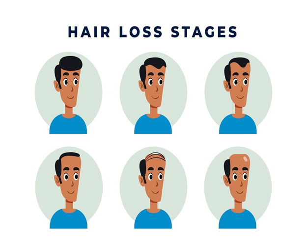 Transform Your Look with Expert Hair Care at ITM Hospital Gwalior