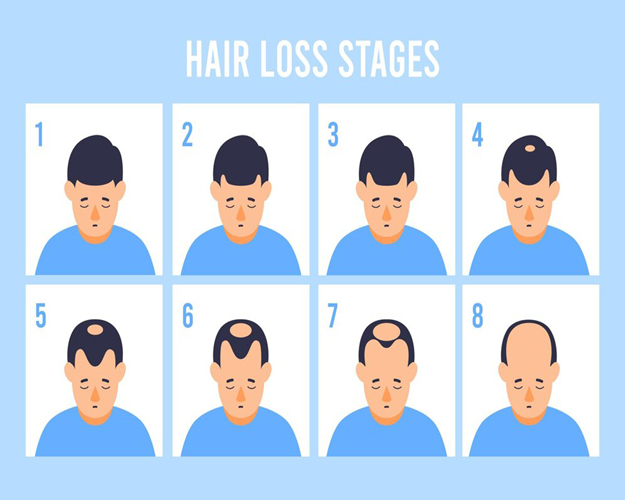 Personalized Hair Transplant Services for a Renewed Confidence at ITM Hospital