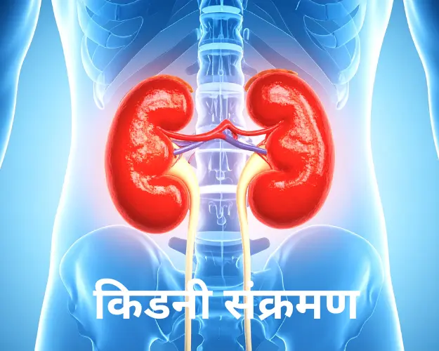 किडनी संक्रमण: कारण, लक्षण और उपचार | नेफ्रोलॉजी गाइड