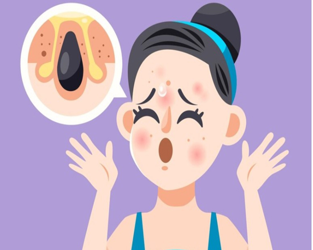 Dermatologist consulting patient for acne treatment at ITM Hospital Gwalior